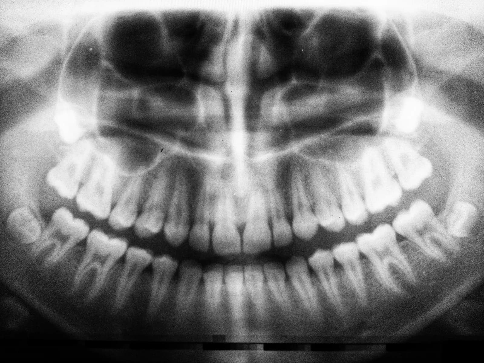 Radiografia panorâmica digital feita no consultório